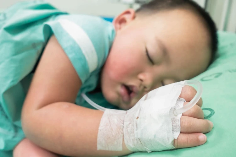 Apert Syndrome Pada Anak: Penyebab, Gejala, dan Obat