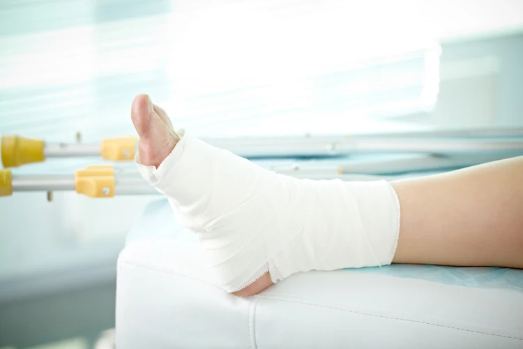 Apa Bedanya Cedera Akibat Patah Tulang dan Keseleo?