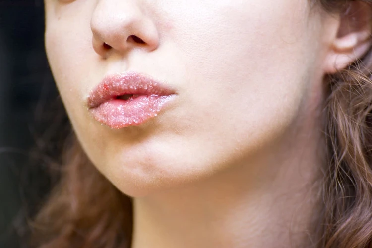 Ketahui Cara Untuk Membuat Scrub Bibir Alami 
