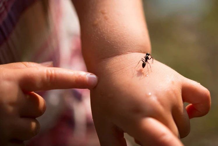 Sengatan Semut Api Pada Anak: Penyebab, Gejala, dan Obat