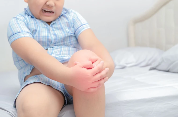 Leg Injury Pada Anak: Penyebab, Gejala, dan Obat