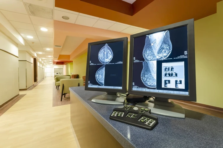 Mammografi untuk Mengetahui Kondisi Payudara