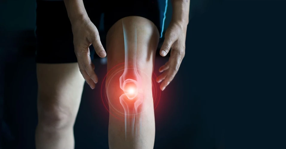 Lutut Terasa Panas Seolah Terbakar? Begini Cara Mengatasi Sesuai Penyebabnya!