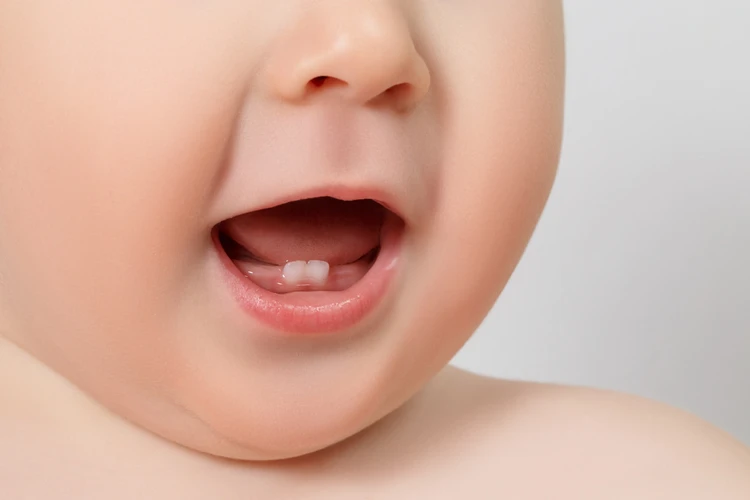 Bayi Demam, Benarkah Pertanda Akan Tumbuh Gigi?