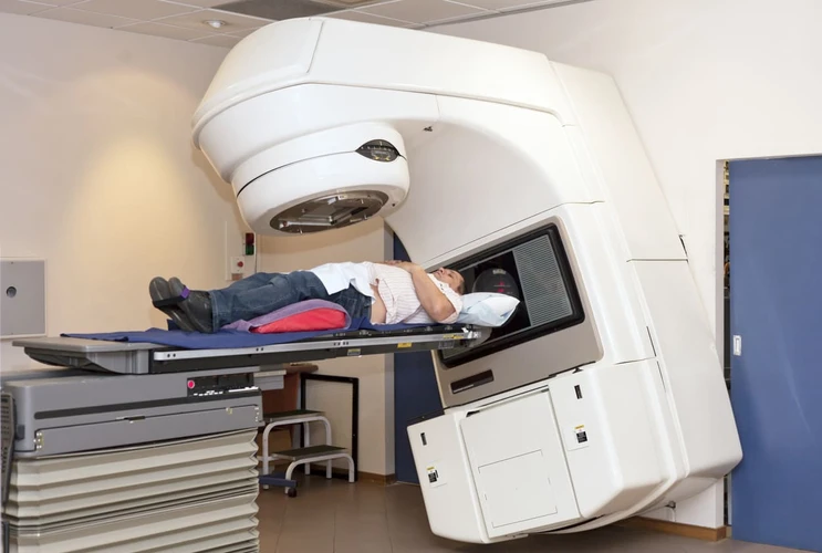 Mengenal Radioterapi untuk Menyembuhkan Kanker Usus Besar