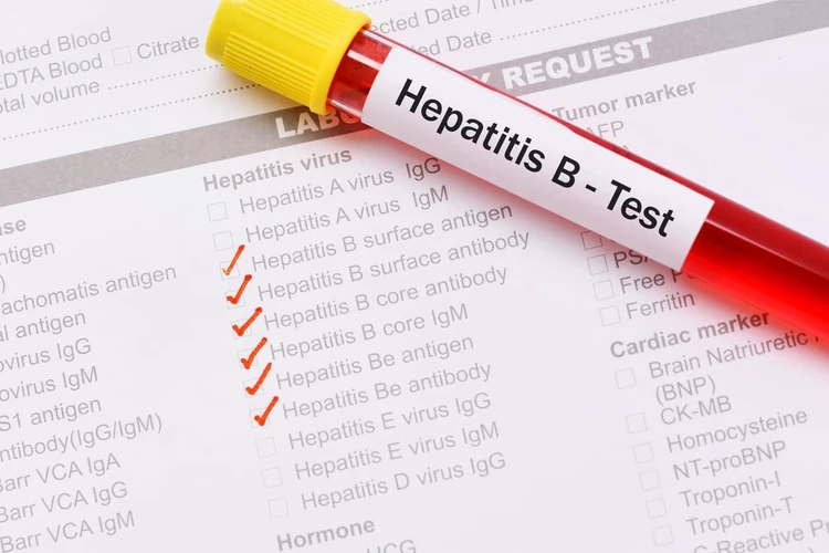 Kenali HBcAg, Tes untuk Mendiagnosis Penyakit Hepatitis B