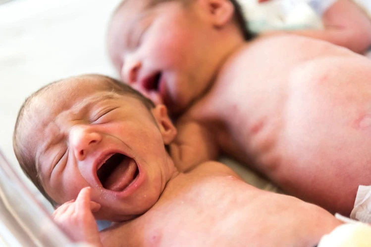 10 Komplikasi Umum Yang Sering Terjadi Pada Kehamilan Kembar