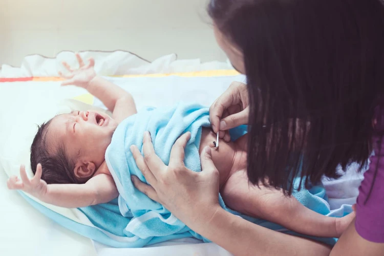 Mengapa Pusar Bayi Baru Lahir Berdarah? Cara Mencegah Pusar Bayi Berdarah