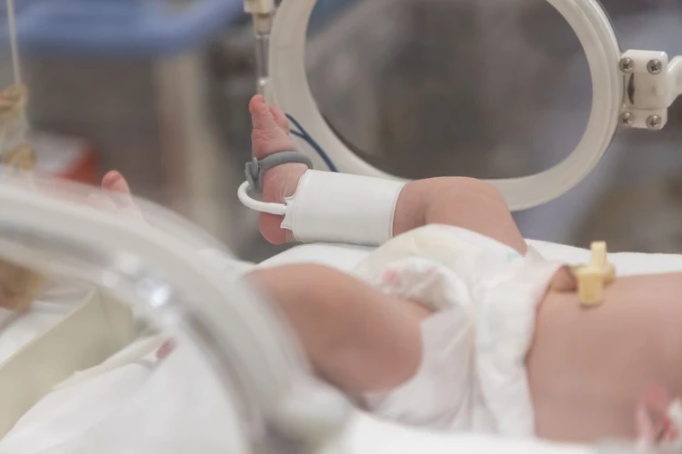 Tekanan Darah Tinggi Pada Bayi: Penyebab, Gejala Dan Perawatan