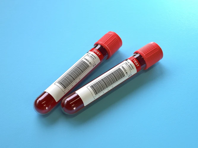 Berapa Kadar Hemoglobin yang Normal Agar Tubuh Sehat? 