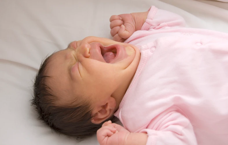 Atresia Bilier pada Bayi: Gejala dan Pengobatan