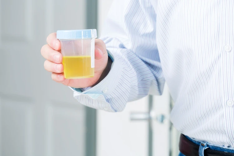 Penyakit Urine Sirup Mapel, Penyakit yang Membuat Urine Beraroma Sirup