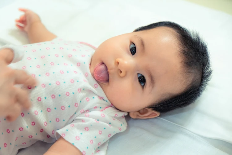 Penyebab Lidah Putih Pada Bayi, Jangan Sepelekan