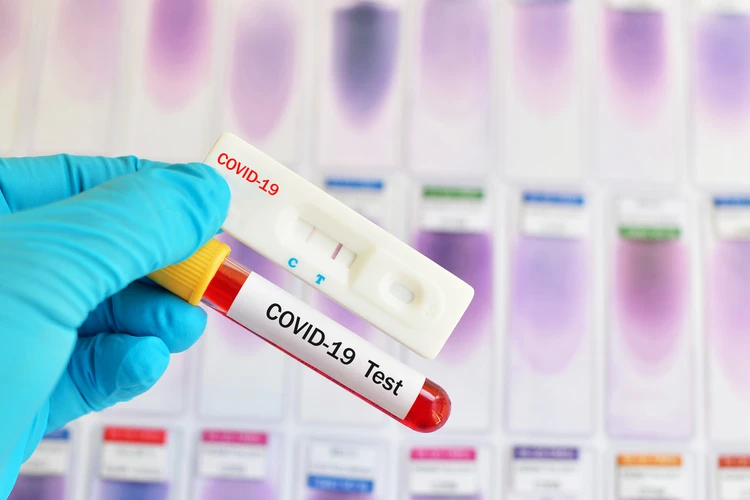 Rapid Test untuk Deteksi Virus Corona, Begini Prosedurnya