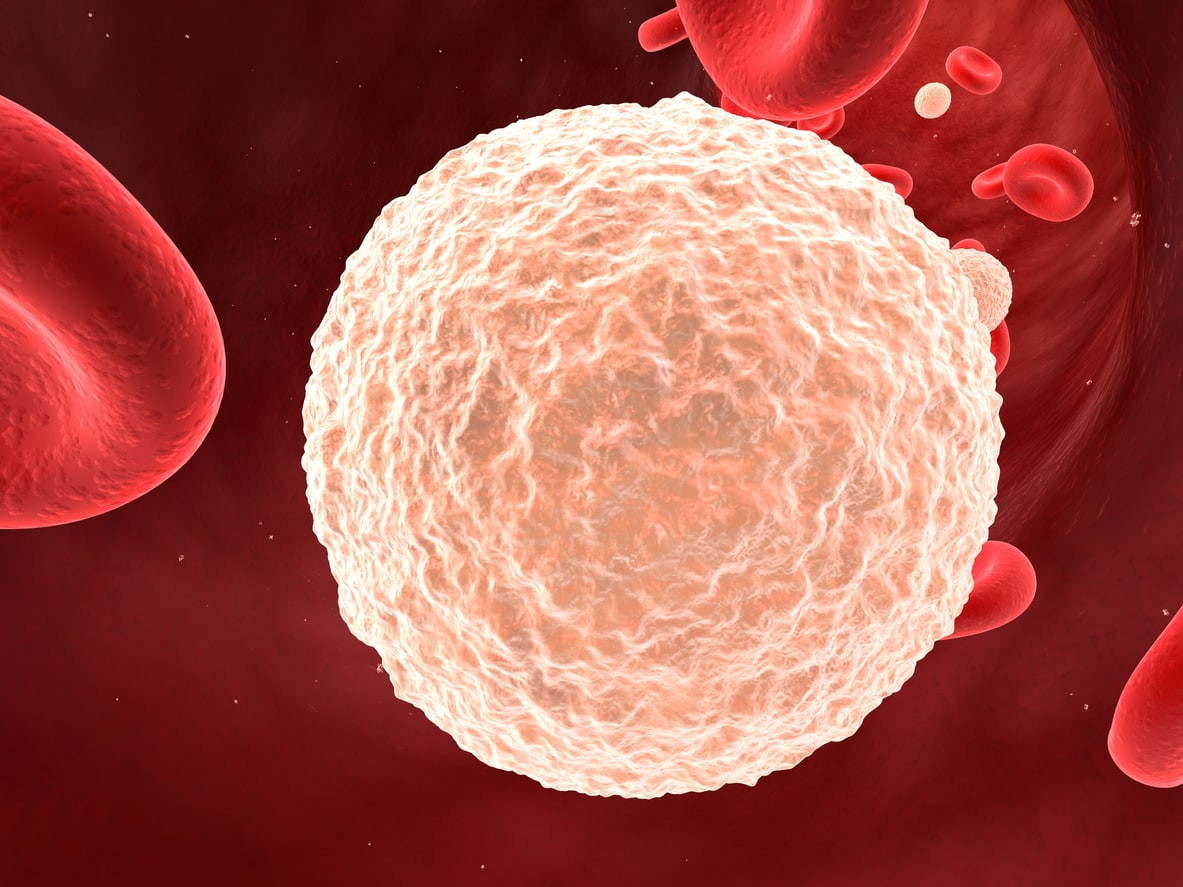 Penyakit yang disebabkan bila sel darah putih diproduksi terlalu banyak dalam tubuh manusia adalah