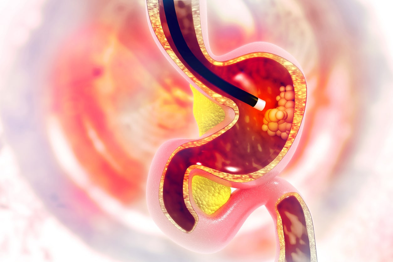 Persiapan Sebelum Melakukan Prosedur Endoskopi HonestDocs