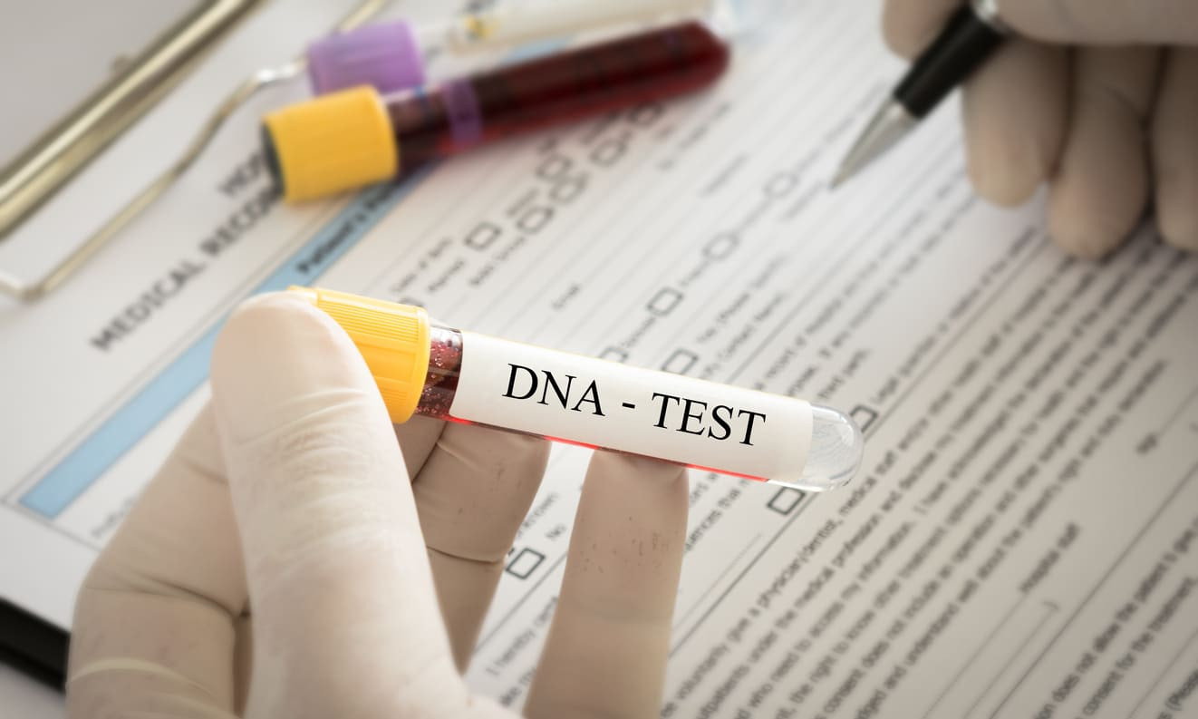 Mengenal Jenis dan Prosedur Tes DNA untuk Mengetahui Garis Keturunan |  HonestDocs