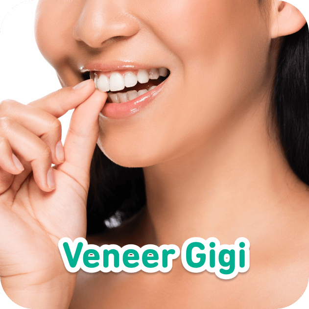 HDReview: Veneer Gigi para Customer