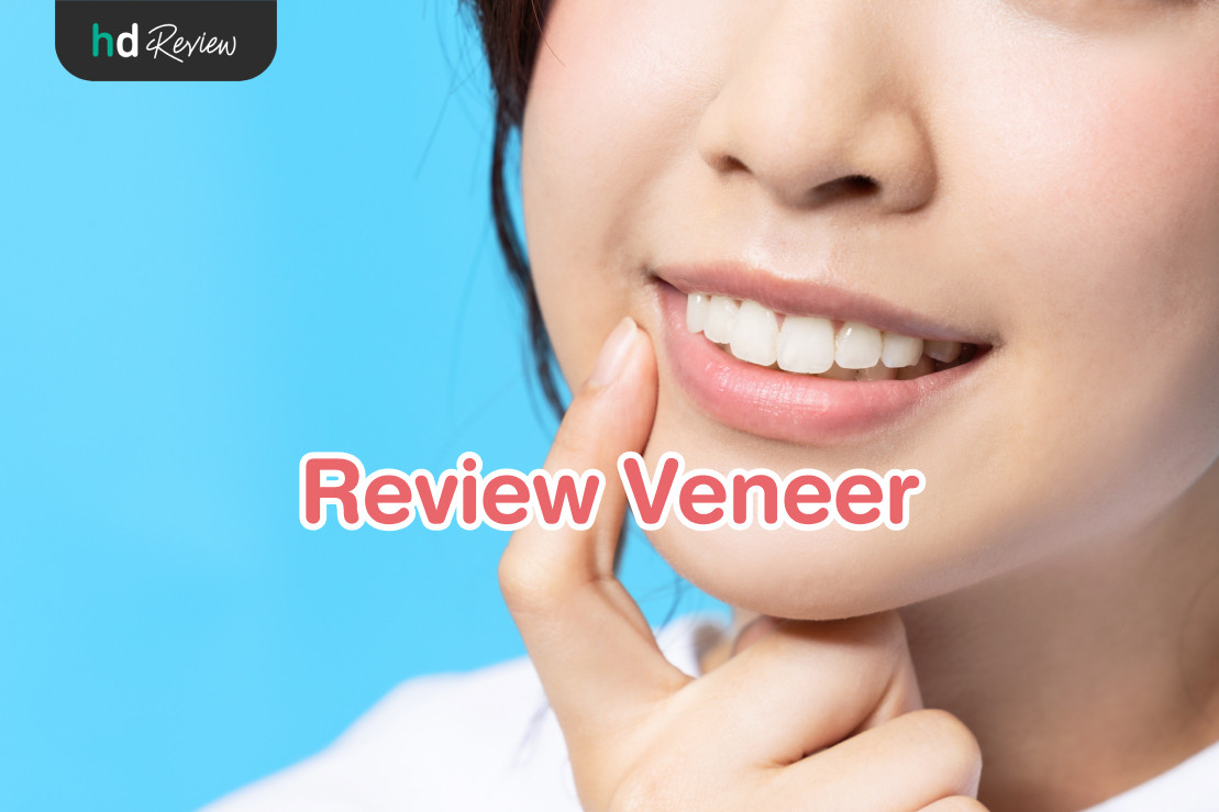 Veneer reviews