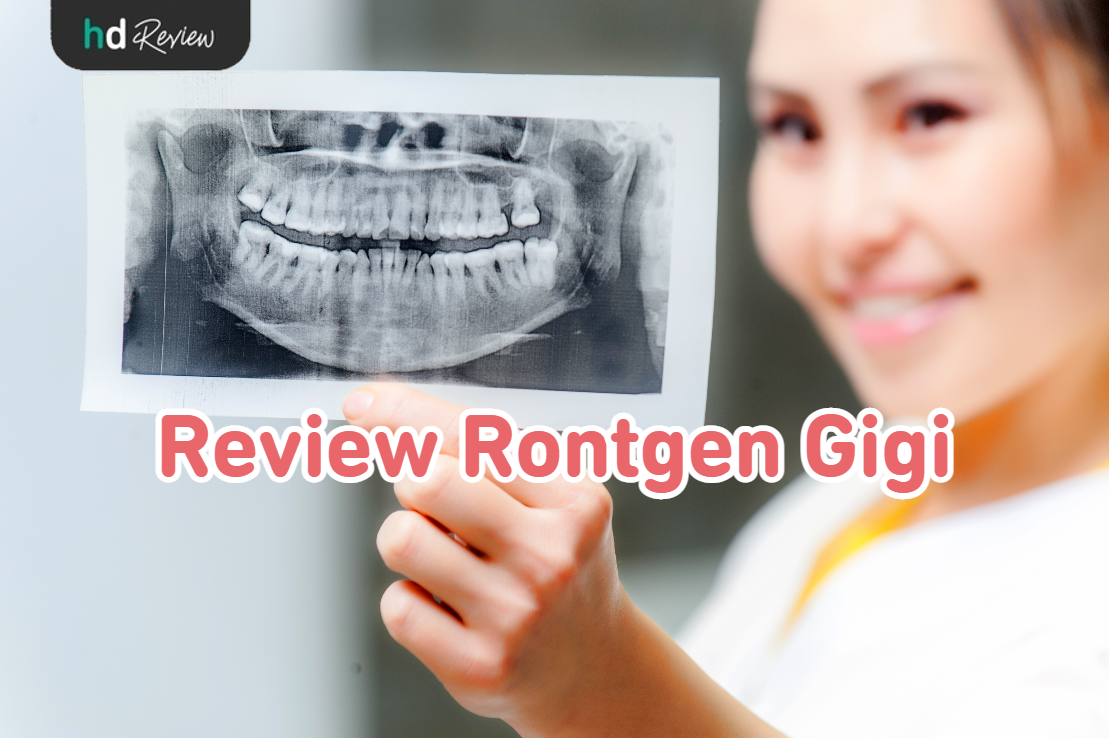 Rontgen Gigi reviews