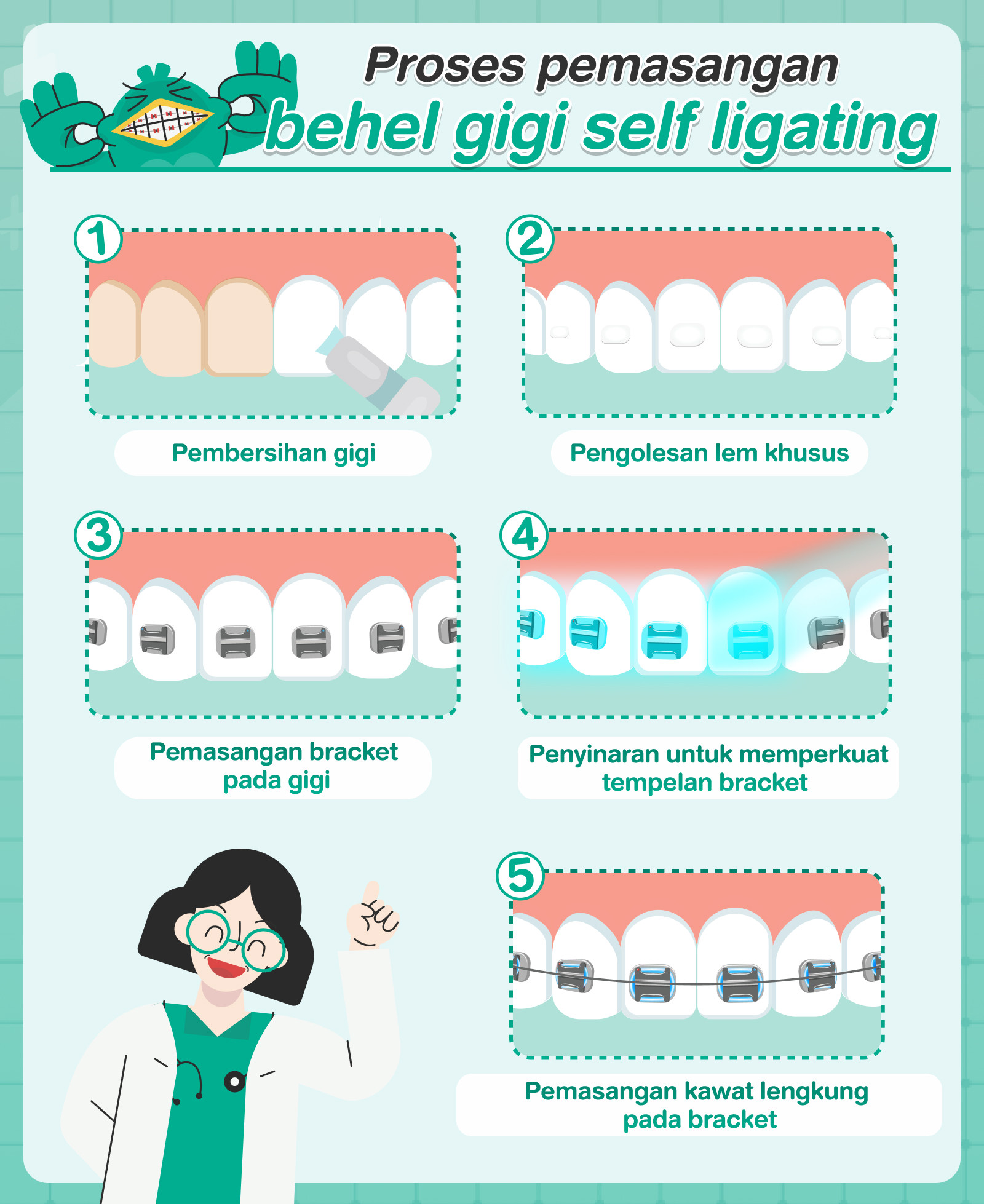 Proses pemasangan behel gigi self ligating